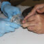 AUDIO-Aumentan casos de picaduras de víboras y arañas en Querétaro