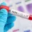 Querétaro, entre los estados con más defunciones por influenza estacional